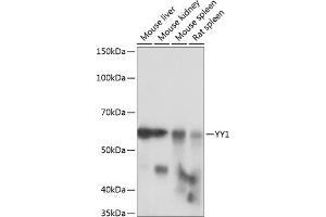 Western blot analysis of extracts of various cell lines, using YY1 antibody (ABIN7271428) at 1:1000 dilution. (YY1 antibody)