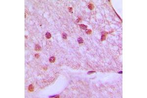 Immunohistochemical analysis of HOXA1 staining in human brain formalin fixed paraffin embedded tissue section. (HOXA1 antibody  (Center))