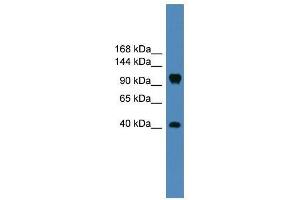 Western Blot showing CNTN1 antibody used at a concentration of 1-2 ug/ml to detect its target protein. (Contactin 1 antibody  (Middle Region))