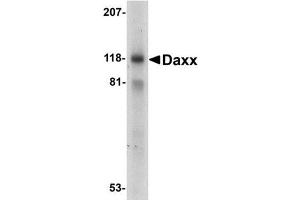 Western blot analysis of Daxx in 293 total cell lysate with AP30275PU-N Dax antibody at 1 mg/ml. (DAXX antibody  (C-Term))