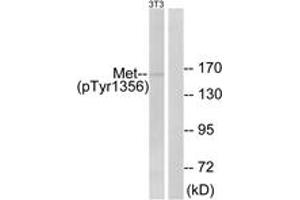 Western blot analysis of extracts from NIH-3T3 cells, using Met (Phospho-Tyr1356) Antibody. (c-MET antibody  (pTyr1356))