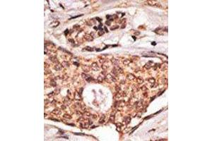 Image no. 2 for anti-Inducible T-Cell Co-Stimulator (ICOS) (C-Term) antibody (ABIN358624)