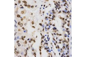 Immunohistochemistry (IHC) image for anti-Histone 3 (H3) (H3K9me3) antibody (ABIN3016030) (Histone 3 antibody  (H3K9me3))