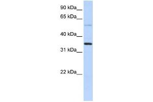 Western Blotting (WB) image for anti-Ankyrin Repeat Domain 9 (ANKRD9) antibody (ABIN2459592) (ANKRD9 antibody)