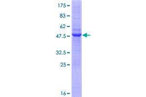 RNF170 Protein (AA 1-200) (GST tag)