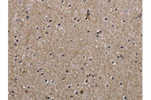 The image on the left is immunohistochemistry of paraffin-embedded Human brain tissue using ABIN7130674(PPAT Antibody) at dilution 1/50, on the right is treated with fusion protein. (PPAT antibody)