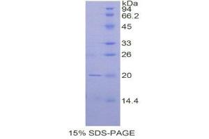 SDS-PAGE (SDS) image for CD247 Molecule (CD247) (AA 1-157) protein (His tag) (ABIN1878046)