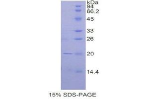 SDS-PAGE (SDS) image for CD247 Molecule (CD247) (AA 1-157) protein (His tag) (ABIN1878046)