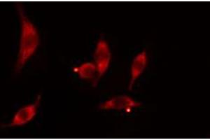 ABIN6274473 staining HT29 cells by IF/ICC. (ITPKC antibody  (N-Term))