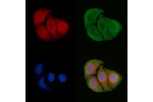 ABIN6265700 and ABIN6266665 staining Hela cells by IF/ICC. (TRADD antibody  (N-Term))