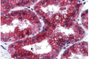 Human Prostate: Formalin-Fixed, Paraffin-Embedded (FFPE) (KDM4C antibody  (C-Term))