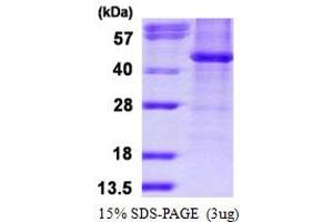 SDS-PAGE (SDS) image for Histone Deacetylase 8 (HDAC8) (AA 1-377) protein (His tag) (ABIN667992)