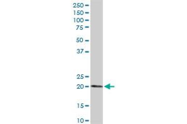 ESM1 antibody  (AA 1-184)