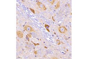 Immunohistochemistry of paraffin embedded rat epencephalon using CRMP3 (ABIN7073734) at dilution of 1:650 (400x lens)