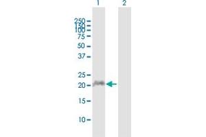 Western Blot analysis of APOBEC3C expression in transfected 293T cell line by APOBEC3C MaxPab polyclonal antibody.