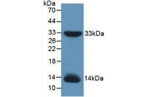 Western blot analysis of recombinant Mouse IRS1.