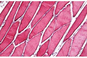 Human Skeletal Muscle: Formalin-Fixed, Paraffin-Embedded (FFPE) (CA3 antibody  (AA 1-261))