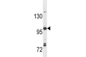 Anti-TLR7 antibody western blot analysis in Ramos lysate (TLR7 antibody  (AA 98-128))