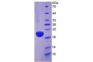 SDS-PAGE analysis of Mouse Aquaporin 4 Protein. (Aquaporin 4 Protein (AQP4))