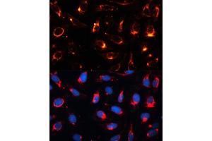 Immunofluorescence analysis of U2OS cells using Cytokeratin 18 (KRT18) antibody (ABIN7268098) at dilution of 1:100. (Cytokeratin 18 antibody  (AA 127-430))