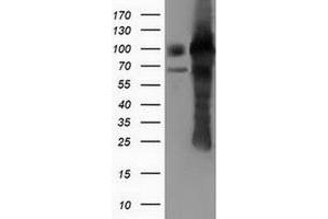 Western Blotting (WB) image for anti-Pseudouridylate Synthase 7 Homolog (PUS7) antibody (ABIN1500514) (PUS7 antibody)