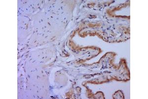 Immunohistochemistry (Paraffin-embedded Sections) (IHC (p)) image for anti-Matrix Metalloproteinase 2 (MMP2) (AA 401-500) antibody (ABIN707426)
