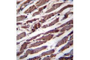 Formalin fixed, paraffin embedded human skeletal muscle stained with PUS1 Antibody (C-term) followed by peroxidase conjugation of the secondary antibody and DAB staining (PUS1 antibody  (C-Term))