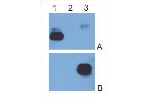 IgG κ light chain (1), IgG λ light chain (2) and IgG Fc fragment (3) purified from human serum were analysed by Western blotting with MEM-09 antibody against IgG κ light chain (A) and EM-07 antibody against IgG Fc fragment (B). (Mouse anti-Human IgG Fc (Fc Region) Antibody (FITC))