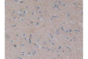 IHC-P analysis of Human Brain Tissue, with DAB staining. (Substance P antibody)