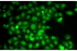 Immunofluorescence analysis of A549 cells using TRAF4 Polyclonal Antibody (TRAF4 antibody)