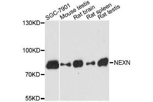 Western blot analysis of extracts of various cell lines, using NEXN antibody. (NEXN antibody  (AA 516-675))