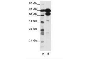 Image no. 1 for anti-Zinc Finger Protein 76 (Expressed in Testis) (ZNF76) (N-Term) antibody (ABIN202772)