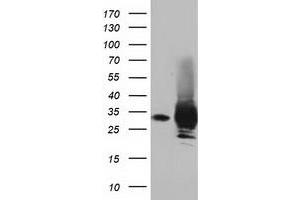 HEK293T cells were transfected with the pCMV6-ENTRY control (Left lane) or pCMV6-ENTRY PYCR2 (Right lane) cDNA for 48 hrs and lysed. (PYCR2 antibody)