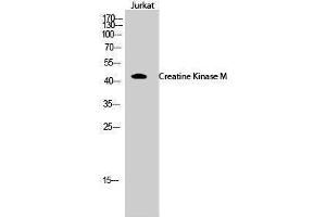 Western Blotting (WB) image for anti-Creatine Kinase, Muscle (CKM) (N-Term) antibody (ABIN3184074) (CKM antibody  (N-Term))