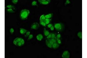 Immunofluorescence staining of MCF-7 cells with ABIN7159558 at 1:100, counter-stained with DAPI. (MACC1 antibody  (AA 371-514))
