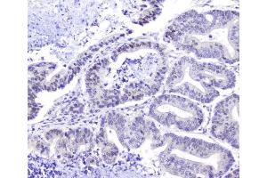 IHC analysis of Hsp105 using anti-Hsp105 antibody (ABIN5693036).