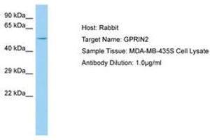 Image no. 1 for anti-G Protein Regulated Inducer of Neurite Outgrowth 2 (GPRIN2) (AA 21-70) antibody (ABIN6750104)