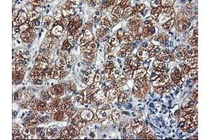 Immunohistochemical staining of paraffin-embedded Human liver tissue using anti-HARS2 mouse monoclonal antibody. (HARS2 antibody)