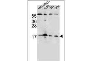 FGF22 Antibody (N-term) (ABIN656125 and ABIN2845466) western blot analysis in MDA-M,K562,293,CEM cell line lysates (35 μg/lane).
