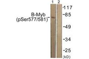 Western blot analysis of extracts from K562 cells, using B-Myb (Phospho-Ser577/581) Antibody. (MYBL2 antibody  (pSer577))