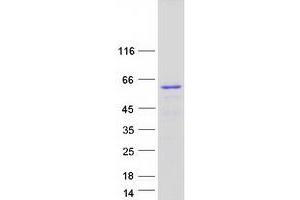 Validation with Western Blot