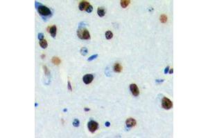 Immunohistochemical analysis of DLX3 staining in human brain formalin fixed paraffin embedded tissue section. (DLX3 antibody  (Center))