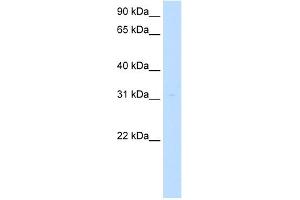 WB Suggested Anti-MLF2 Antibody Titration:  5. (MLF2 antibody  (Middle Region))