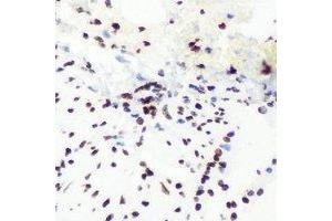 Immunohistochemical analysis of SHARP-2 staining in mouse lung formalin fixed paraffin embedded tissue section. (BHLHE40 antibody)