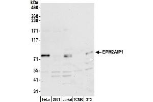 anti-EPM2A (Laforin) Interacting Protein 1 (EPM2AIP1) (AA 100-150) antibody