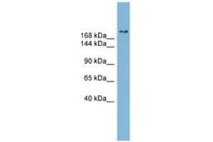 Image no. 1 for anti-SET Binding Protein 1 (SETBP1) (C-Term) antibody (ABIN6742014) (SETBP1 antibody  (C-Term))