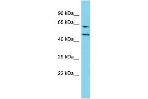 Host: Rabbit Target Name: WDR85 Sample Type: Jurkat Whole Cell lysates Antibody Dilution: 1.