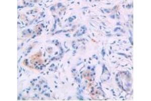 Immunohistochemistry (IHC) image for anti-Interleukin 4 (IL4) (AA 25-153) antibody (ABIN7425656)