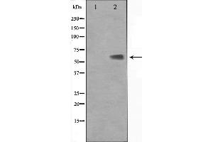 Western blot analysis on Jurkat cell lysate using KLF11 Antibody.