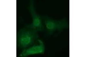 Immunofluorescence (IF) image for anti-EPM2A (Laforin) Interacting Protein 1 (EPM2AIP1) antibody (ABIN1498043) (EPM2AIP1 antibody)